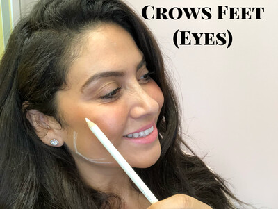 Crows Feet