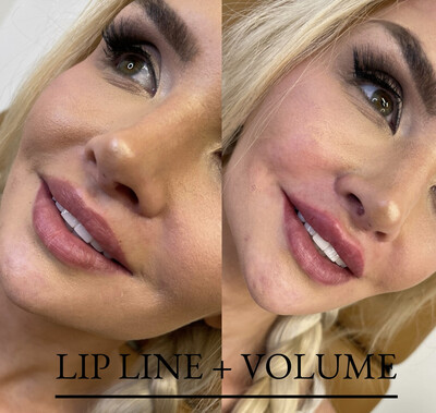 Lips