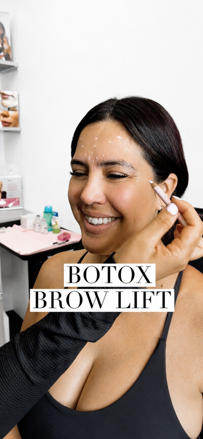 Nonsurgical Brow Lift