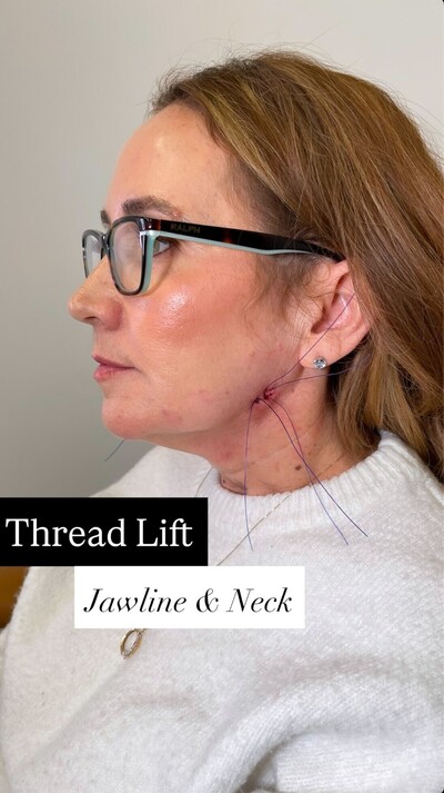 Jawline & Neck
